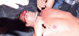 Great Khali Injured