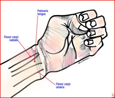 Palmar Ligaments