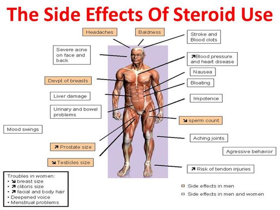 Side Effects of Steroids